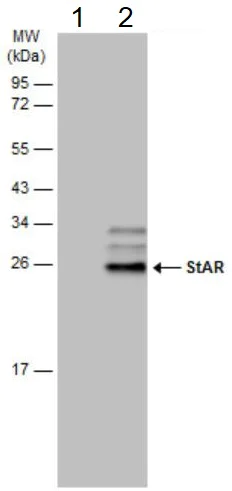 Western blot - Anti-StAR antibody (AB96637)