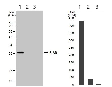 Western blot - Anti-StAR antibody (AB96637)