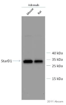 Western blot - Anti-StAR antibody (AB96637)