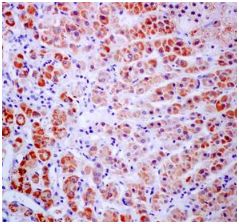 Immunohistochemistry (Formalin/PFA-fixed paraffin-embedded sections) - Anti-StAR antibody [EP7639] (AB133657)