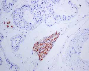 Immunohistochemistry (Formalin/PFA-fixed paraffin-embedded sections) - Anti-StAR antibody [EP7639] (AB133657)