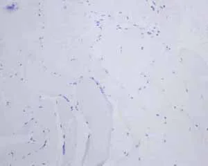 Immunohistochemistry (Formalin/PFA-fixed paraffin-embedded sections) - Anti-StAR antibody [EP7639] (AB133657)