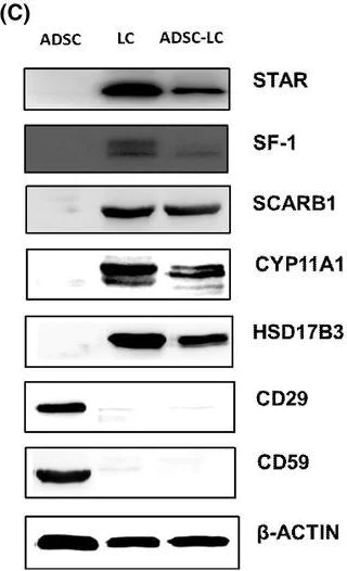 Western blot - Anti-StAR antibody [EP7639] (AB133657)