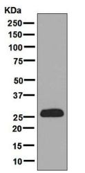 Western blot - Anti-StAR antibody [EP7639] (AB133657)