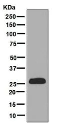 Western blot - Anti-StAR antibody [EP7639] (AB133657)