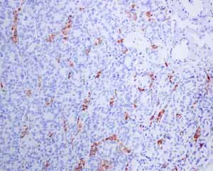 Immunohistochemistry (Formalin/PFA-fixed paraffin-embedded sections) - Anti-StAR antibody [EP7639] - BSA and Azide free (AB244236)