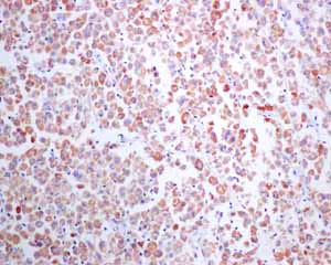 Immunohistochemistry (Formalin/PFA-fixed paraffin-embedded sections) - Anti-StAR antibody [EP7639] - BSA and Azide free (AB244236)