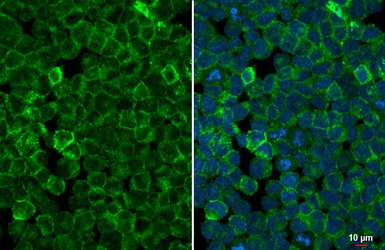 Immunocytochemistry/ Immunofluorescence - Anti-StAR antibody [HL1362] (AB307801)