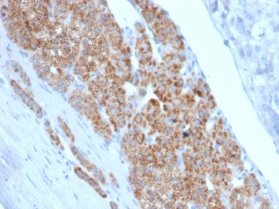 Immunohistochemistry (Formalin/PFA-fixed paraffin-embedded sections) - Anti-StAR antibody [STAR/2140] (AB238056)