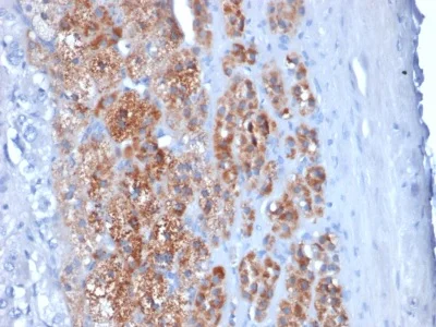 Immunohistochemistry (Formalin/PFA-fixed paraffin-embedded sections) - Anti-StAR antibody [STAR/2154] (AB238057)