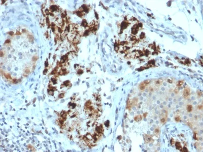 Immunohistochemistry (Formalin/PFA-fixed paraffin-embedded sections) - Anti-StAR antibody [STAR/2154] (AB238057)