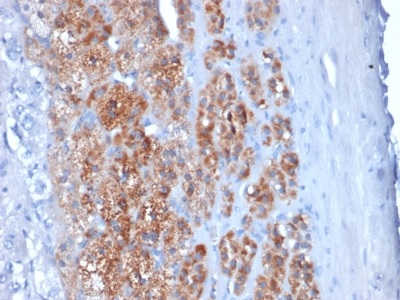Immunohistochemistry (Formalin/PFA-fixed paraffin-embedded sections) - Anti-StAR antibody [STAR/2154] - BSA and Azide free (AB237908)