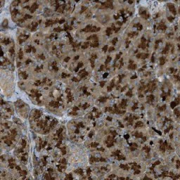 Immunohistochemistry (Formalin/PFA-fixed paraffin-embedded sections) - Anti-StARD13 antibody (AB126489)