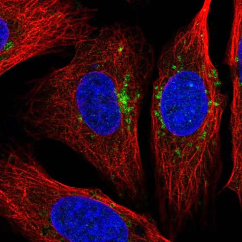 Immunocytochemistry/ Immunofluorescence - Anti-STARD3NL antibody (AB121592)