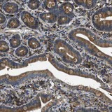 Immunohistochemistry (Formalin/PFA-fixed paraffin-embedded sections) - Anti-STARD3NL antibody (AB121592)