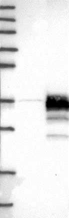 Western blot - Anti-STARD3NL antibody (AB121592)