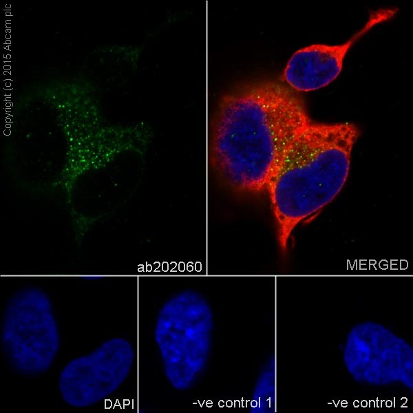 Immunocytochemistry/ Immunofluorescence - Anti-STARD4 antibody [EPR17847-32] (AB202060)