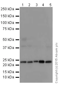 Western blot - Anti-STARD4 antibody [EPR17847-32] (AB202060)