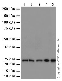 Western blot - Anti-STARD4 antibody [EPR17847-32] (AB202060)