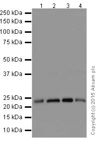 Western blot - Anti-STARD4 antibody [EPR17847-32] - BSA and Azide free (AB251360)