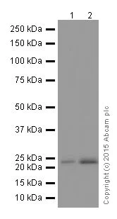 Western blot - Anti-STARD4 antibody [EPR17847-32] - BSA and Azide free (AB251360)