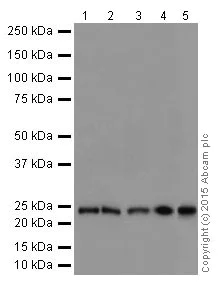 Western blot - Anti-STARD4 antibody [EPR17847-32] - BSA and Azide free (AB251360)