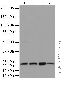 Western blot - Anti-STARD4 antibody [EPR17847] (AB200344)