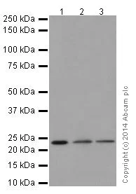 Western blot - Anti-STARD4 antibody [EPR17847] - BSA and Azide free (AB251308)