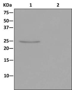 Anti-STARD5 antibody [EPR13545(B)]