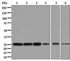 Western blot - Anti-STARD5 antibody [EPR13545(B)] (AB178688)