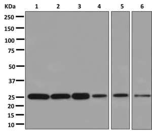 Western blot - Anti-STARD5 antibody [EPR13545(B)] (AB178688)