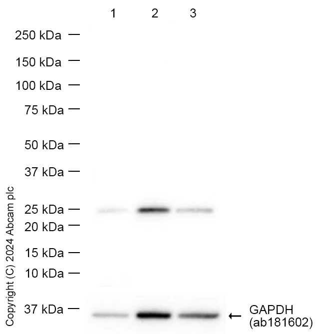 Western blot - Anti-STARD5 antibody [EPR13545(B)] (AB178688)