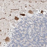 Immunohistochemistry (Formalin/PFA-fixed paraffin-embedded sections) - Anti-STARD9 antibody (AB121438)