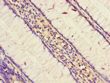 Immunohistochemistry (Formalin/PFA-fixed paraffin-embedded sections) - Anti-STARD9 antibody (AB229993)