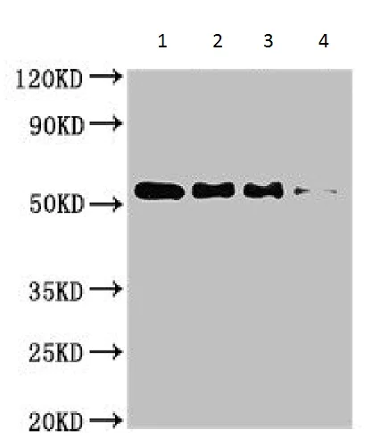Western blot - Anti-STARD9 antibody (AB229993)