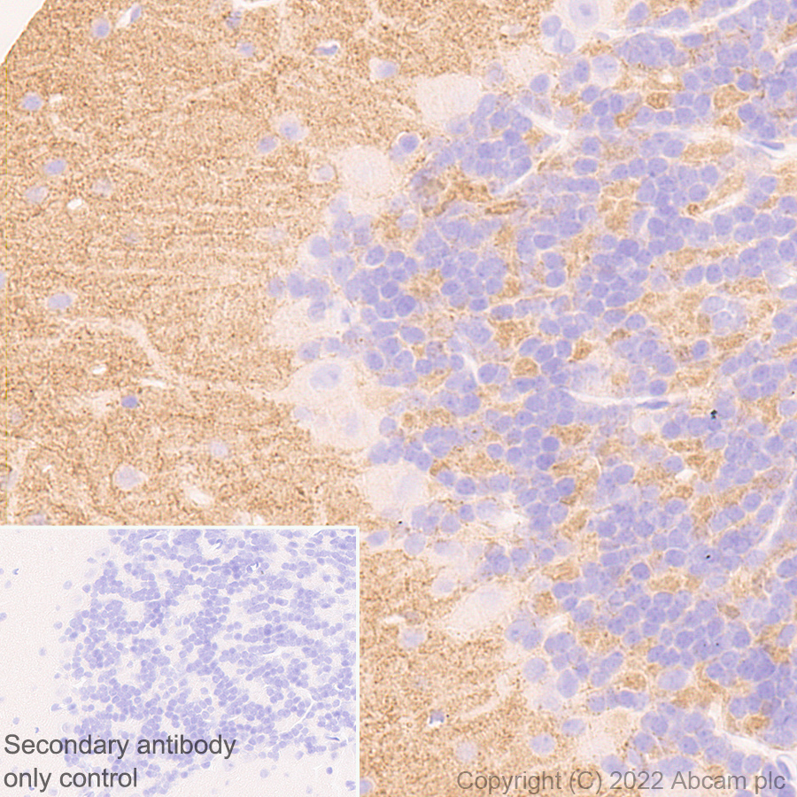 Immunohistochemistry (Formalin/PFA-fixed paraffin-embedded sections) - Anti-Stargazin antibody [EPR25387-48] (ab300519), expandable thumbnail