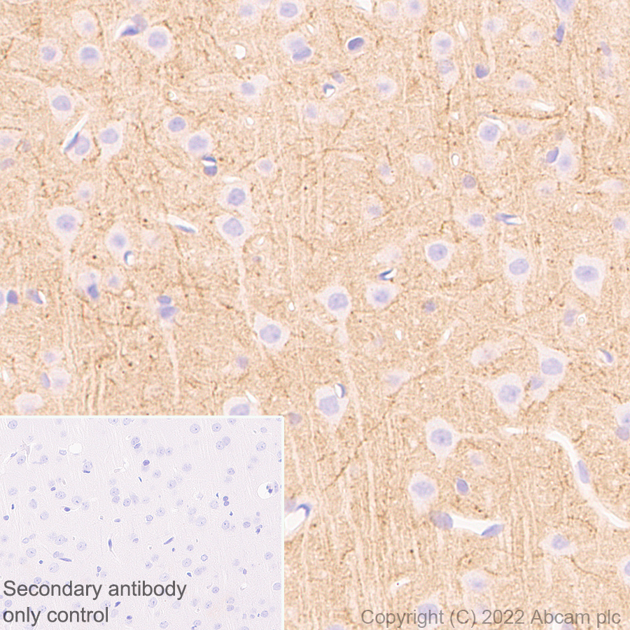 Immunohistochemistry (Formalin/PFA-fixed paraffin-embedded sections) - Anti-Stargazin antibody [EPR25387-48] (ab300519), expandable thumbnail