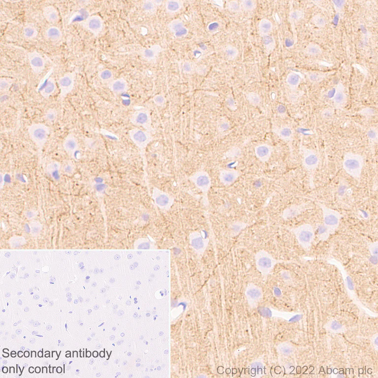 Immunohistochemistry (Formalin/PFA-fixed paraffin-embedded sections) - Anti-Stargazin antibody [EPR25387-48] (AB300519)