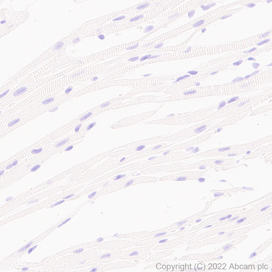 Immunohistochemistry (Formalin/PFA-fixed paraffin-embedded sections) - Anti-Stargazin antibody [EPR25387-48] (ab300519), expandable thumbnail