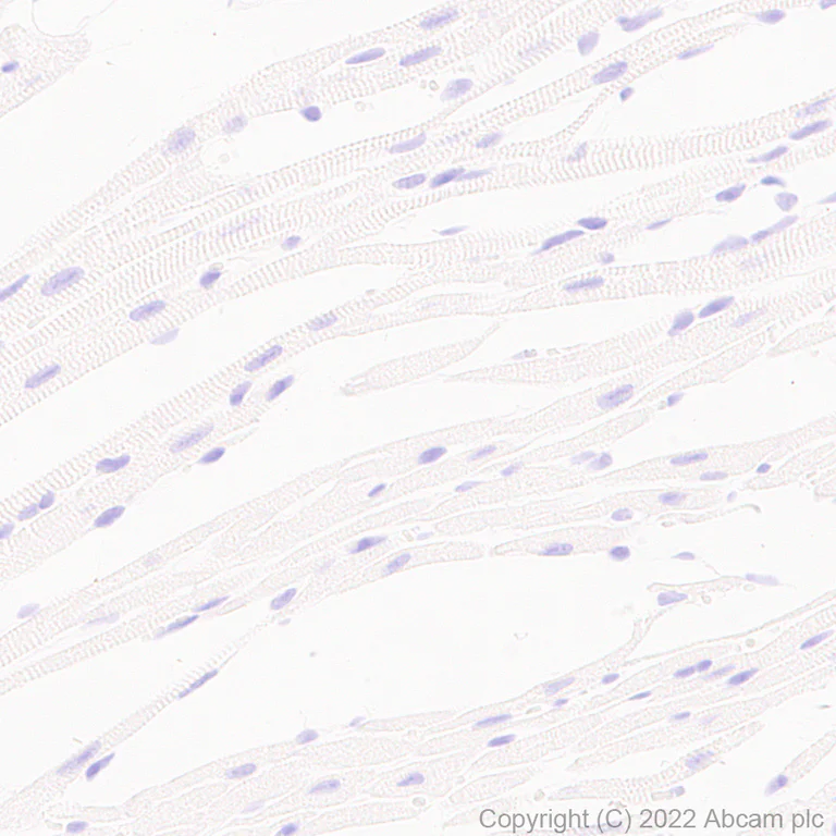 Immunohistochemistry (Formalin/PFA-fixed paraffin-embedded sections) - Anti-Stargazin antibody [EPR25387-48] (AB300519)