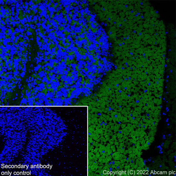 Immunohistochemistry (Frozen sections) - Anti-Stargazin antibody [EPR25387-48] (ab300519), expandable thumbnail