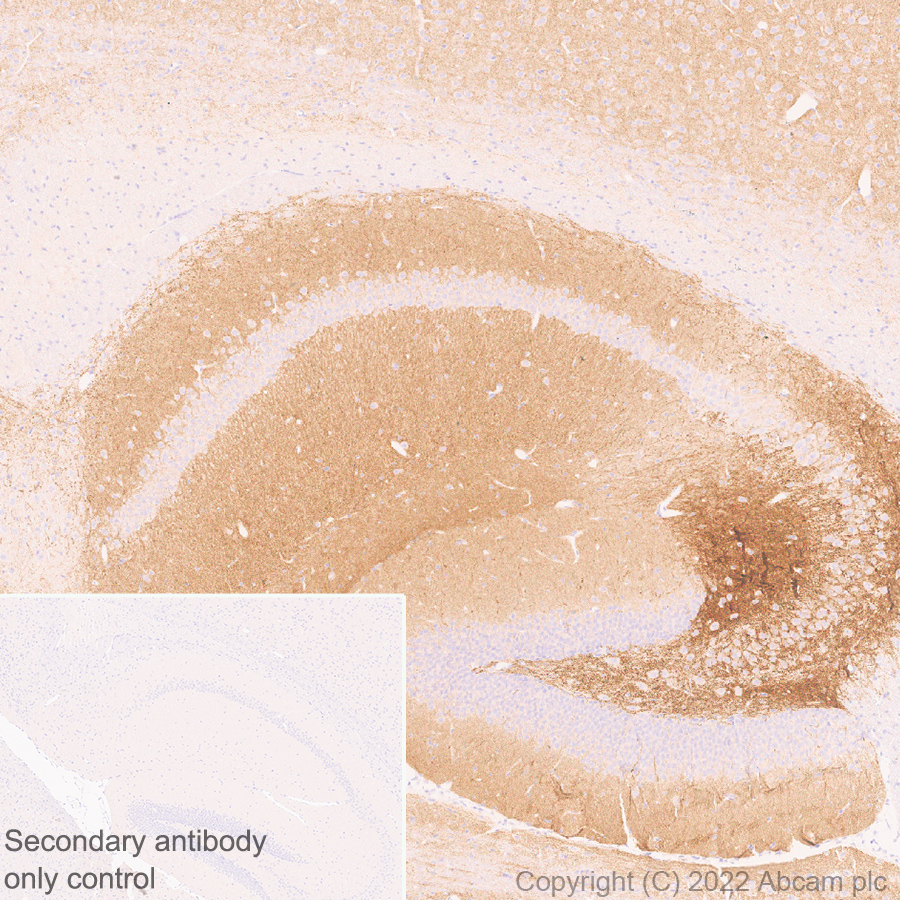 Immunohistochemistry (Formalin/PFA-fixed paraffin-embedded sections) - Anti-Stargazin antibody [EPR25387-48] - BSA and Azide free (ab300520), expandable thumbnail