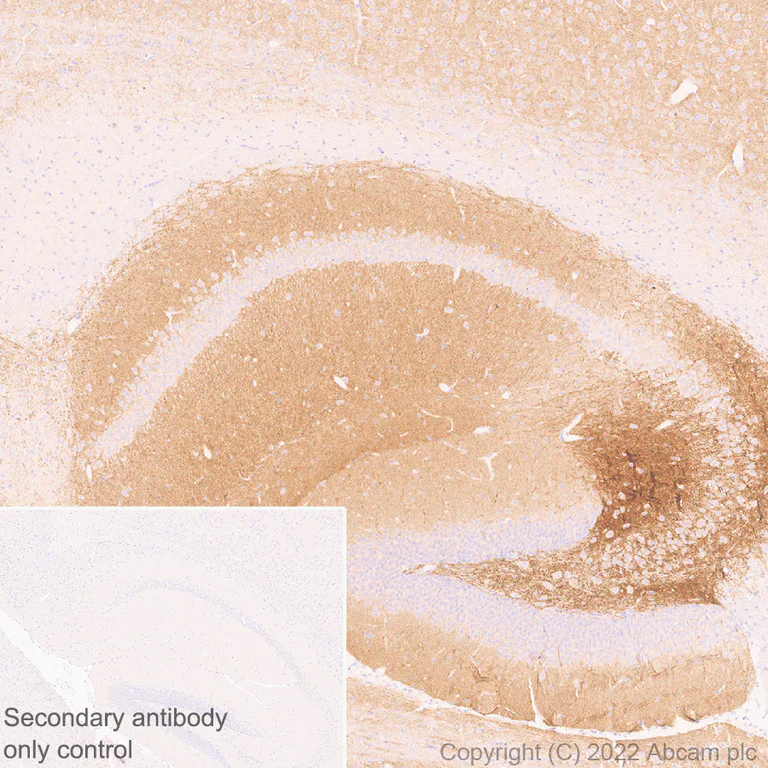 Immunohistochemistry (Formalin/PFA-fixed paraffin-embedded sections) - Anti-Stargazin antibody [EPR25387-48] - BSA and Azide free (AB300520)