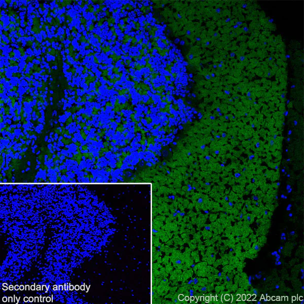 Immunohistochemistry (Frozen sections) - Anti-Stargazin antibody [EPR25387-48] - BSA and Azide free (AB300520)