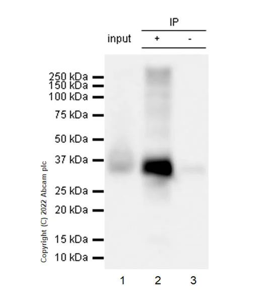 Immunoprecipitation - Anti-Stargazin antibody [EPR25387-48] - BSA and Azide free (AB300520)