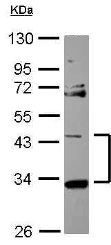 Western blot - Anti-START domain containing 7 antibody (AB101525)