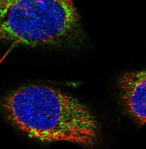 Immunocytochemistry/ Immunofluorescence - Anti-START domain containing 7 antibody (AB221569)