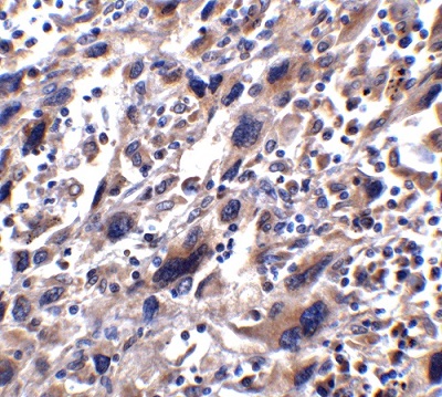 Immunohistochemistry (Formalin/PFA-fixed paraffin-embedded sections) - Anti-STAT1 alpha antibody (AB2071), expandable thumbnail