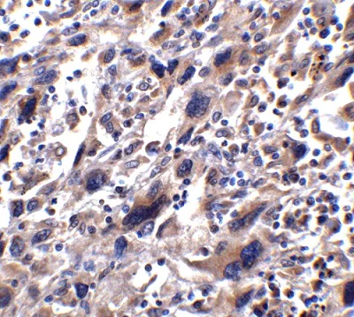 Immunohistochemistry (Formalin/PFA-fixed paraffin-embedded sections) - Anti-STAT1 alpha antibody (AB2071)