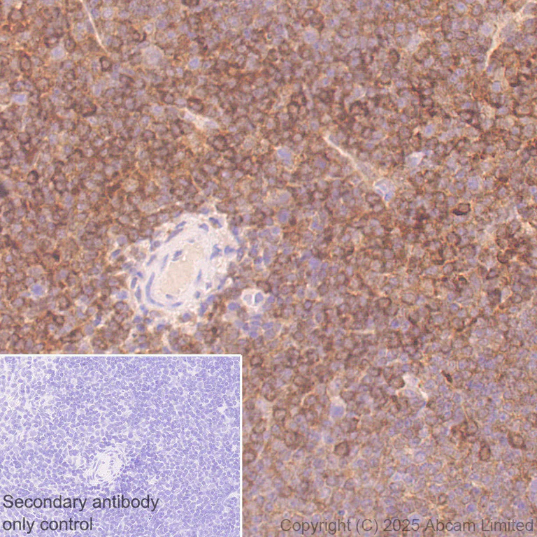 Immunohistochemistry (Formalin/PFA-fixed paraffin-embedded sections) - Anti-STAT1 alpha antibody [EPYR2154] (AB92506)